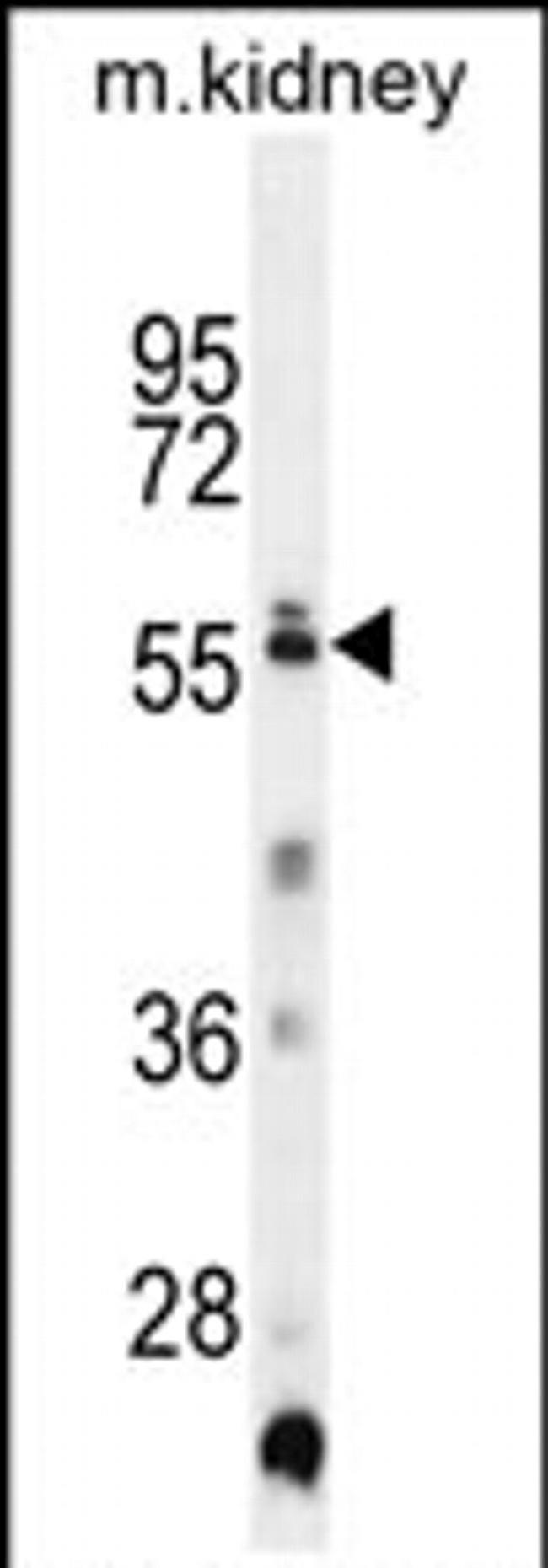 Triml1 Antibody in Western Blot (WB)