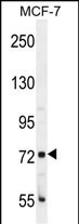 CTAGE4 Antibody in Western Blot (WB)