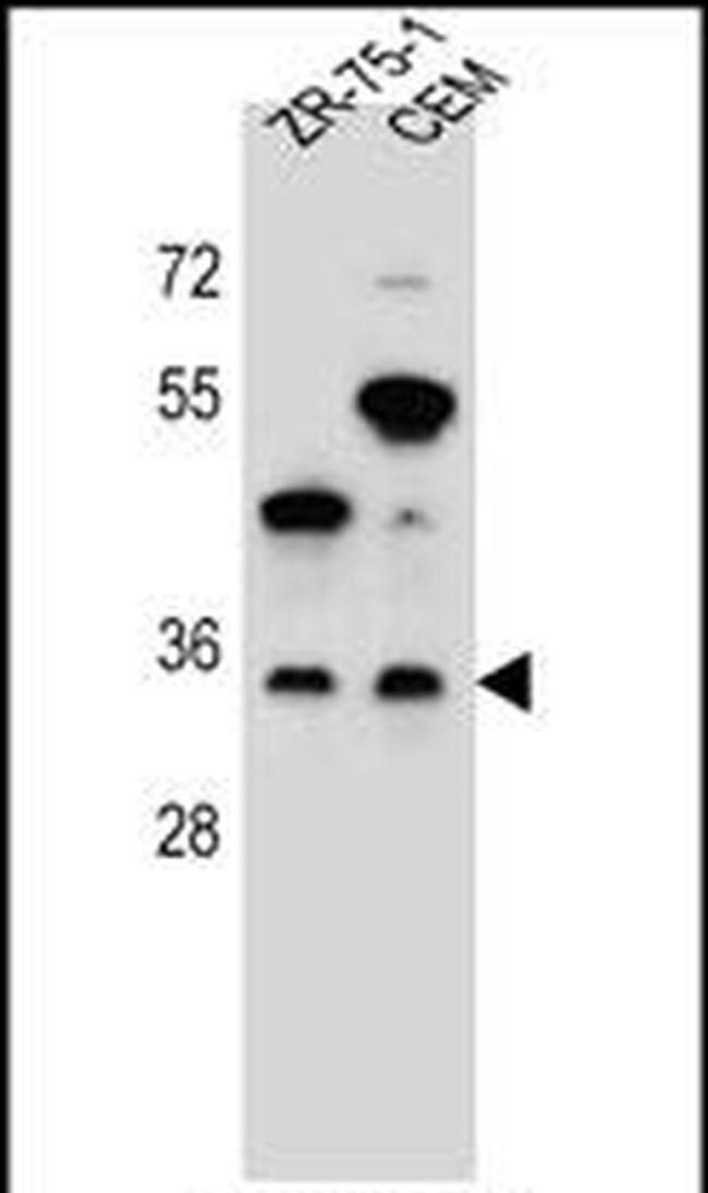 GPM6B Antibody in Western Blot (WB)