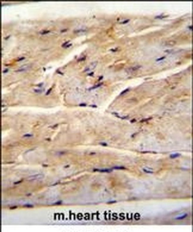 FAM82B Antibody in Immunohistochemistry (IHC)