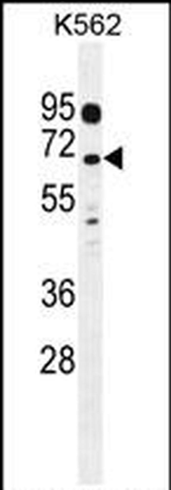 LRRC63 Antibody in Western Blot (WB)