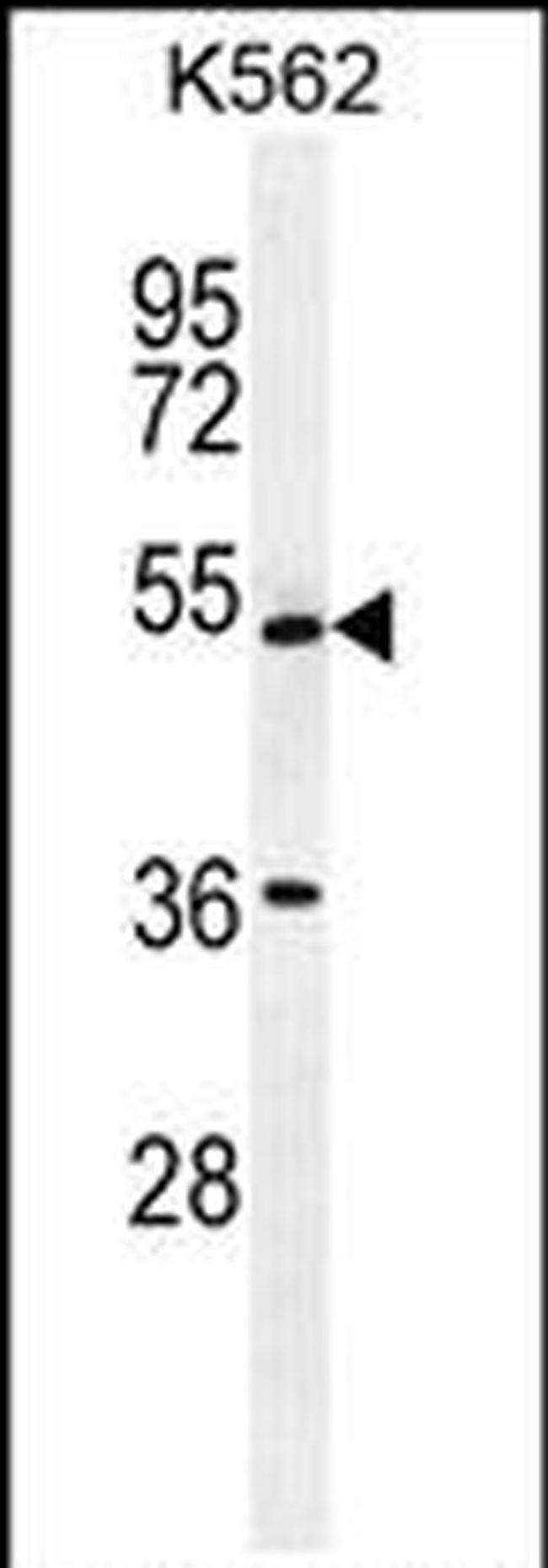 UAP1L1 Antibody in Western Blot (WB)