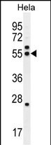 TUBB8P12 Antibody in Western Blot (WB)