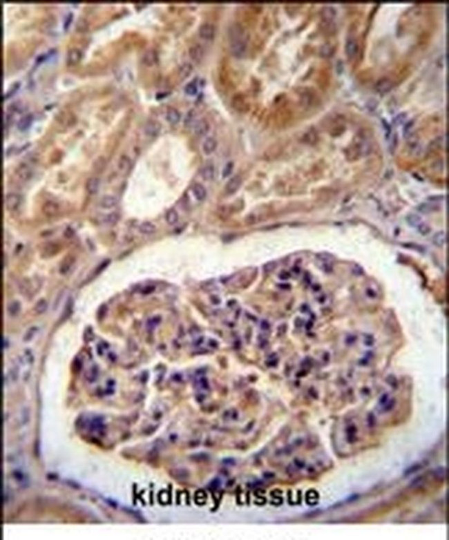 MGP Antibody in Immunohistochemistry (IHC)
