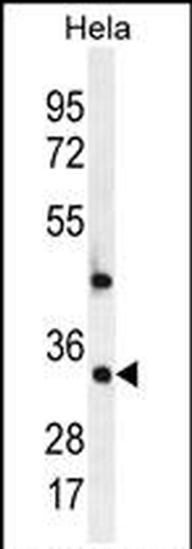 CRSP9 Antibody in Western Blot (WB)