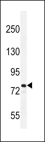 RAD54L Antibody in Western Blot (WB)