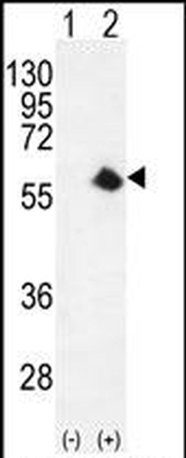 CDK8 Antibody in Western Blot (WB)