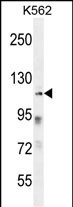 ZNF99 Antibody in Western Blot (WB)