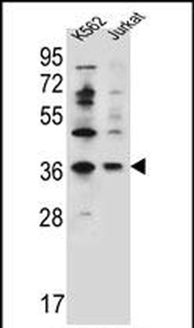 PPP1R3G Antibody in Western Blot (WB)