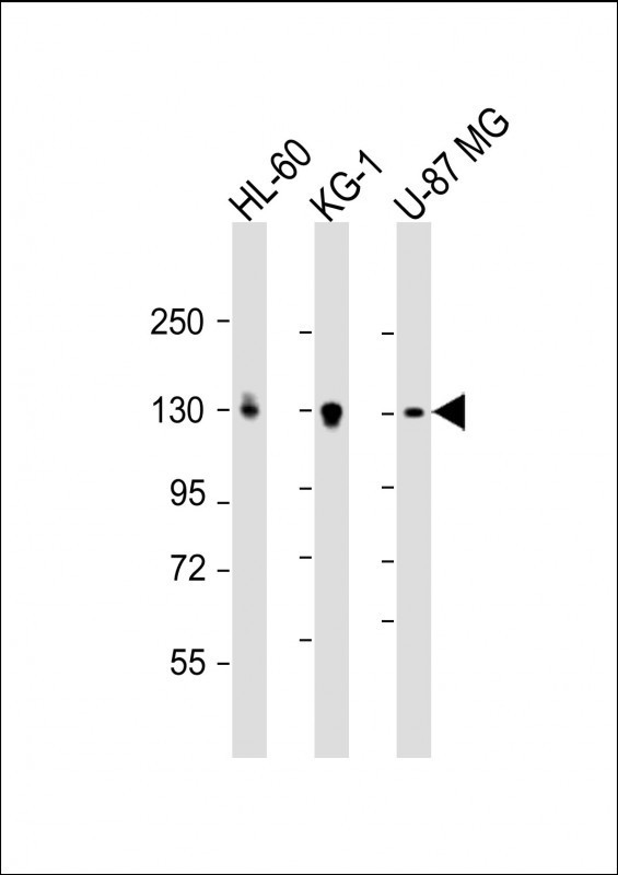 DEPDC5 Antibody in Western Blot (WB)