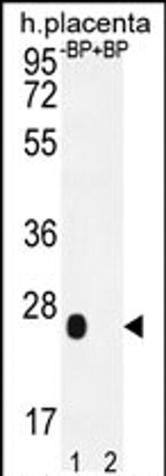 OR2J3 Antibody in Western Blot (WB)