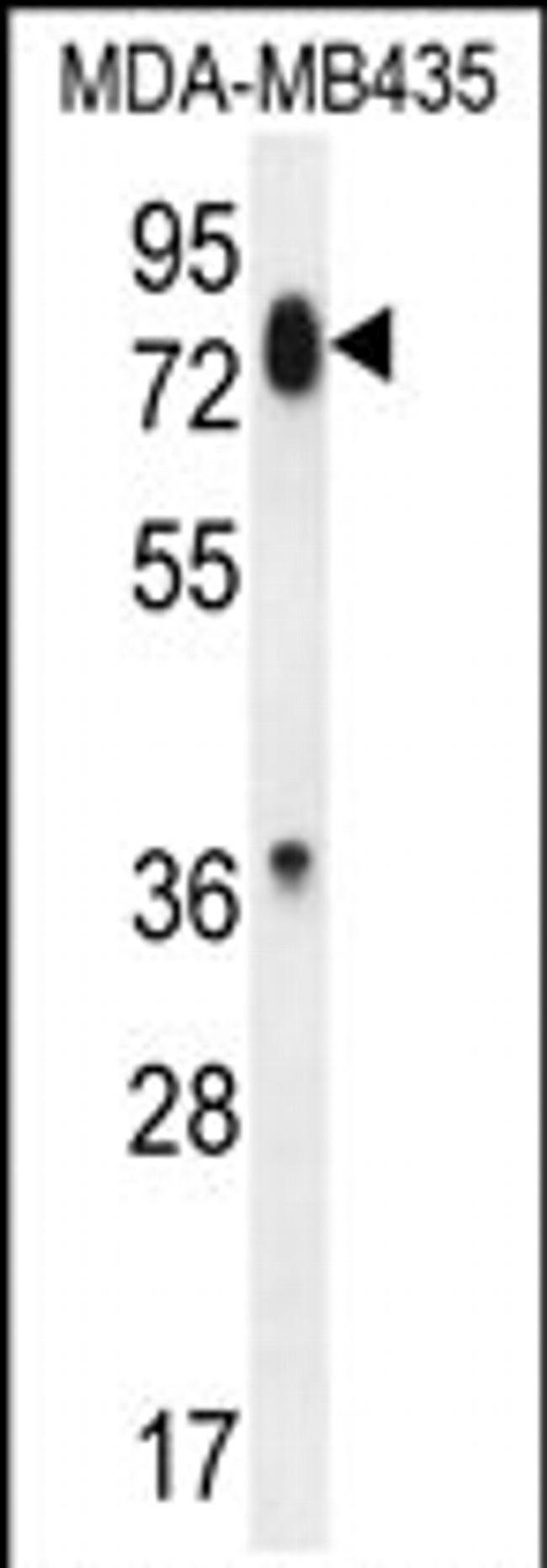 PCDHB13 Antibody in Western Blot (WB)