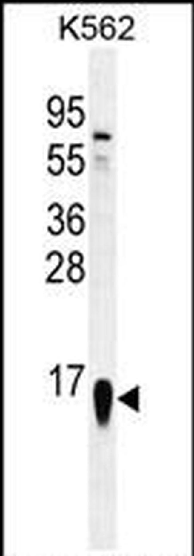 RPS19 Antibody in Western Blot (WB)