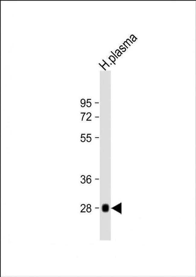Complement Factor D Antibody in Western Blot (WB)