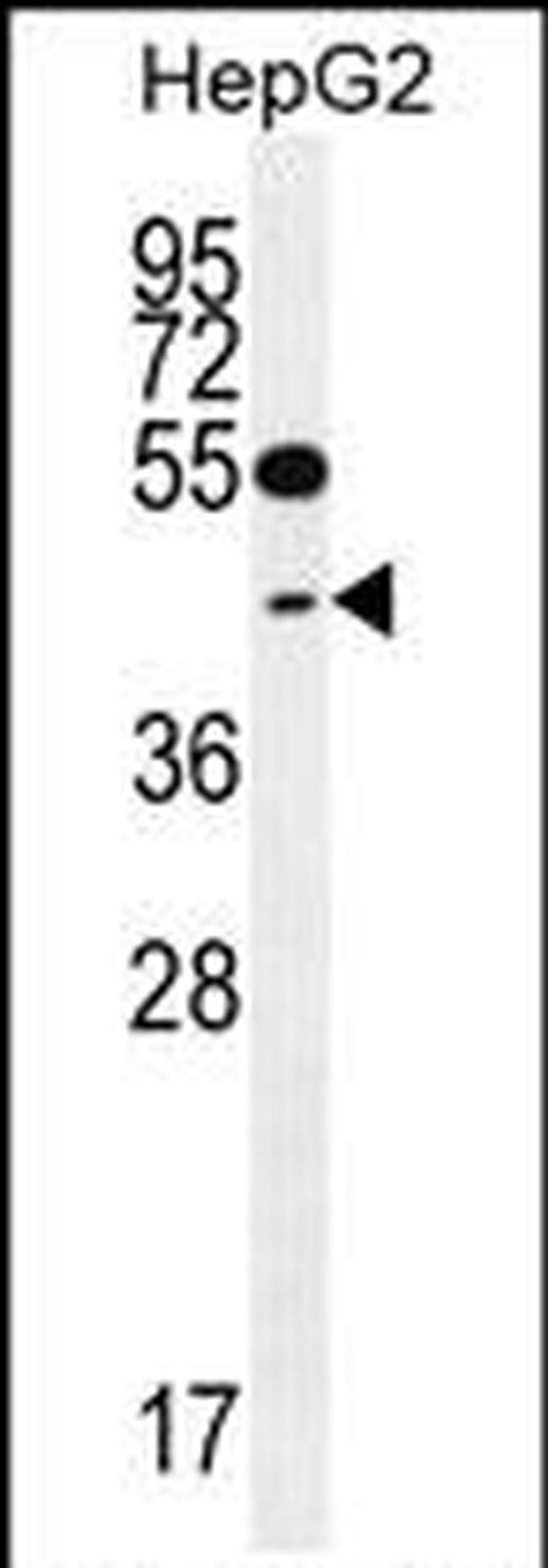 TXNL2 Antibody in Western Blot (WB)
