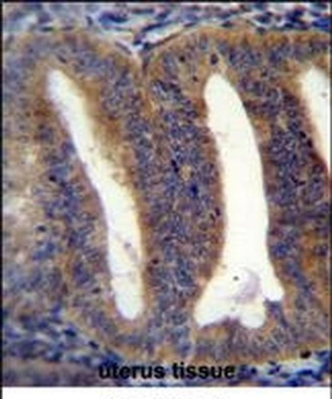 Rbpms2 Antibody in Immunohistochemistry (IHC)