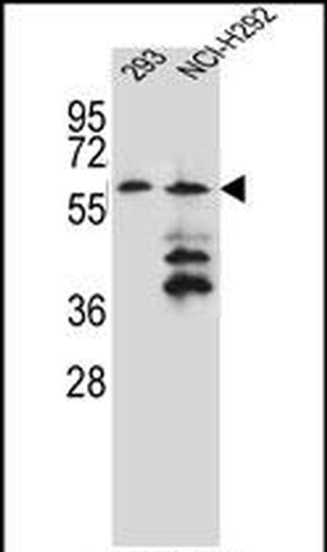 PRAMEF12 Antibody in Western Blot (WB)