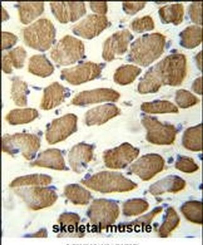 KBTBD13 Antibody in Immunohistochemistry (IHC)
