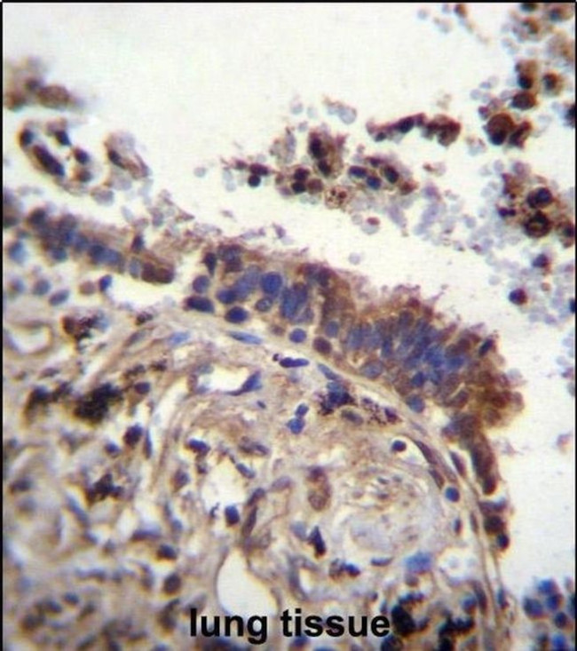 TTBK2 Antibody in Immunohistochemistry (IHC)