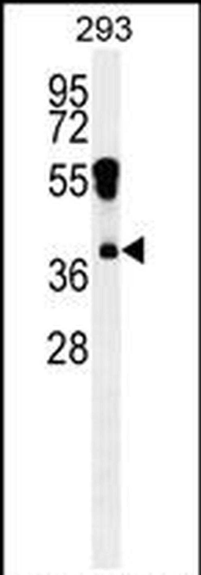 RHOXF2 Antibody in Western Blot (WB)