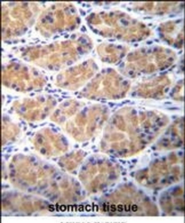 TOR2A Antibody in Immunohistochemistry (IHC)