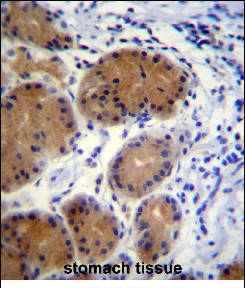 Morn5 Antibody in Immunohistochemistry (Paraffin) (IHC (P))