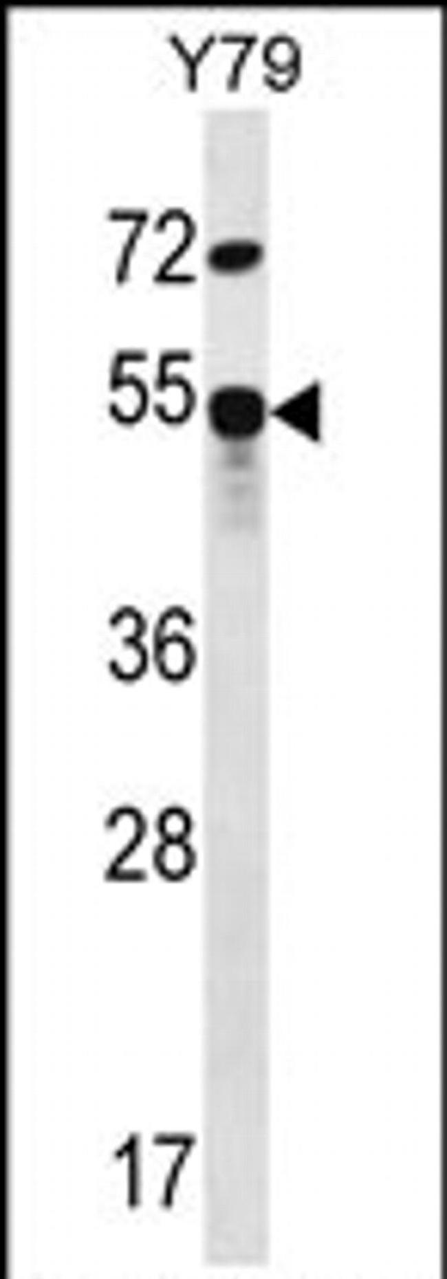 ZFP14 Antibody in Western Blot (WB)