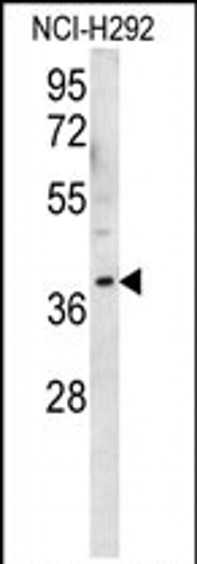 OR2AK2 Antibody in Western Blot (WB)