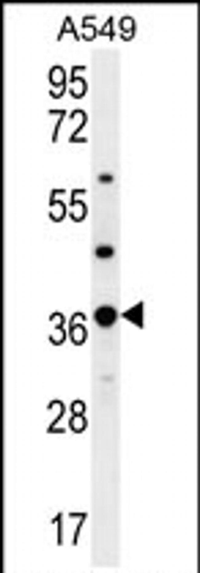 OR4M1 Antibody in Western Blot (WB)