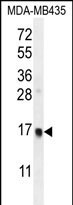 UNQ6493/PRO21345 Antibody in Western Blot (WB)