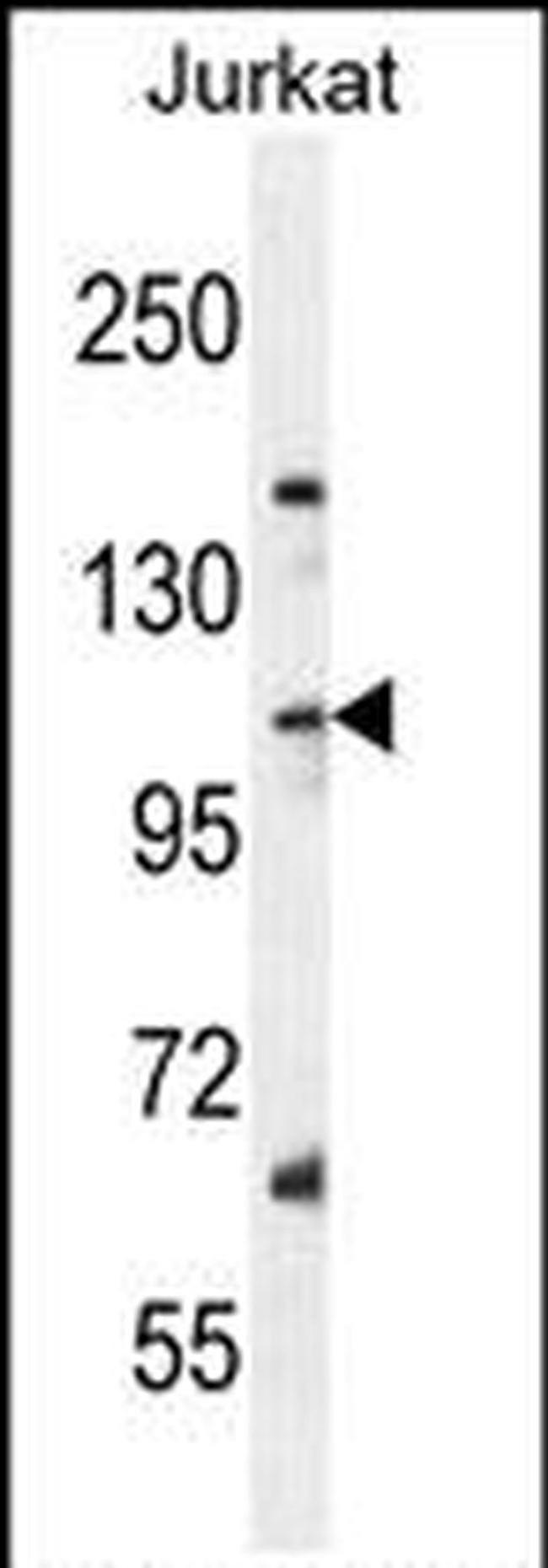 SNX25 Antibody in Western Blot (WB)