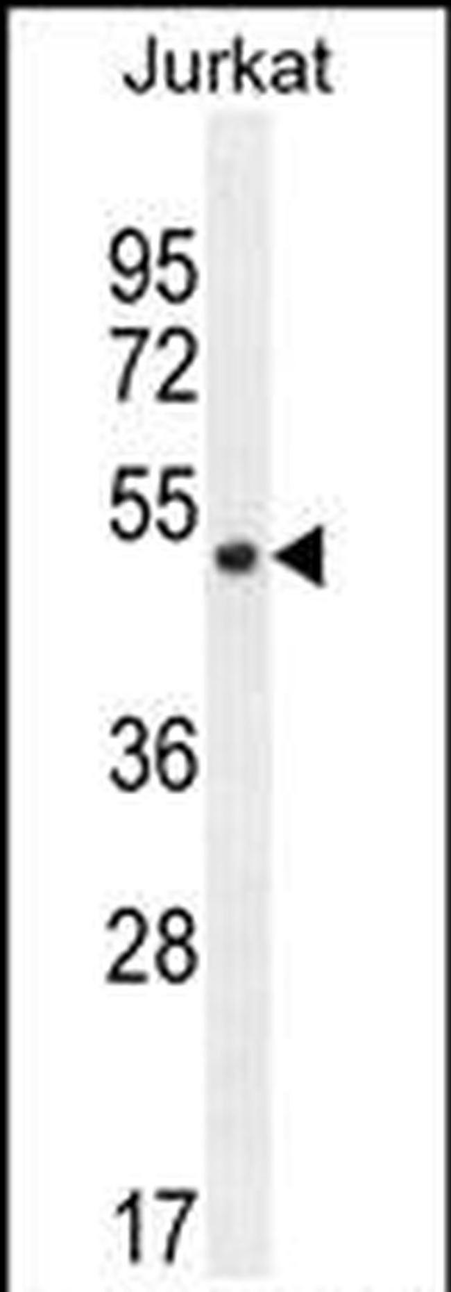 SNIP1 Antibody in Western Blot (WB)
