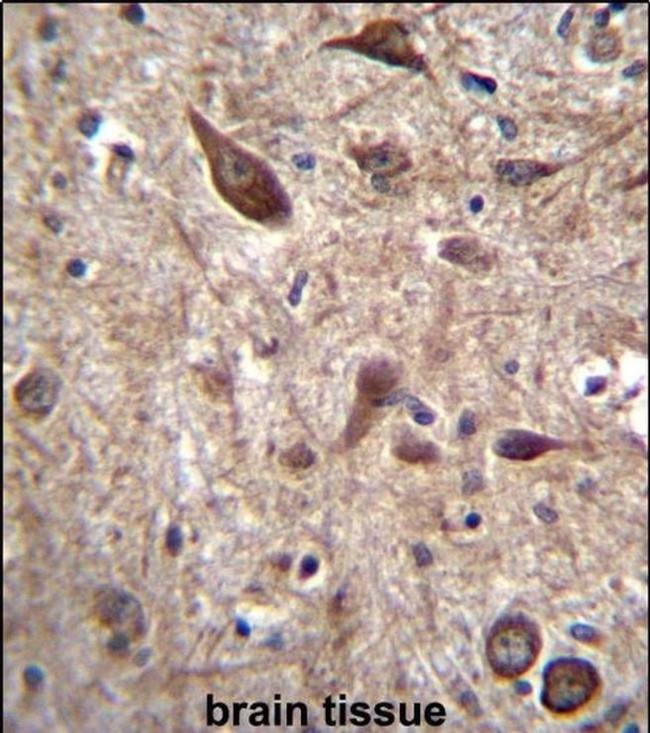 Pleiotrophin Antibody in Immunohistochemistry (IHC)