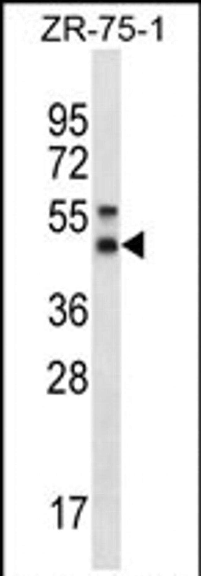 STX5 Antibody in Western Blot (WB)