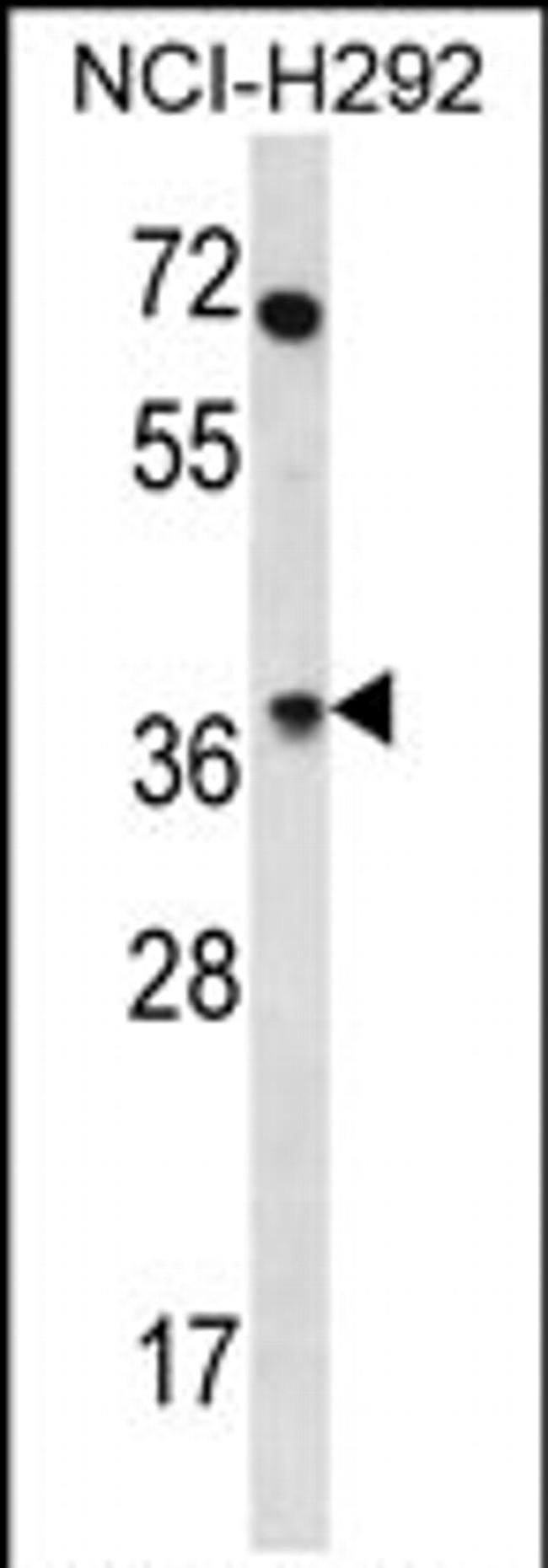 OR4N2 Antibody in Western Blot (WB)