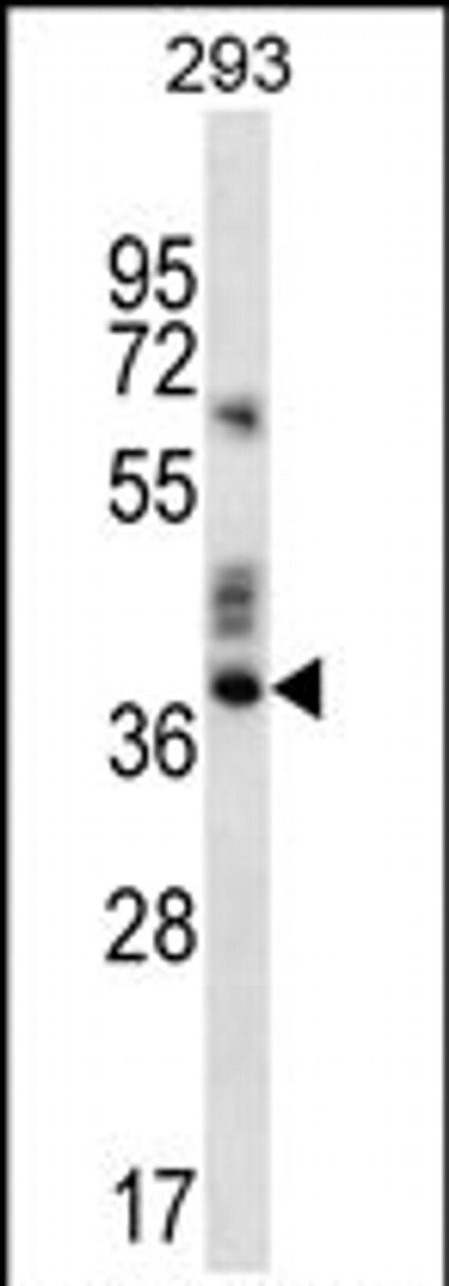 OR9K2 Antibody in Western Blot (WB)