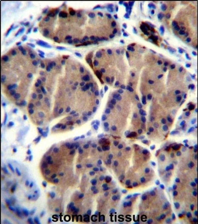 LIPC Antibody in Immunohistochemistry (IHC)
