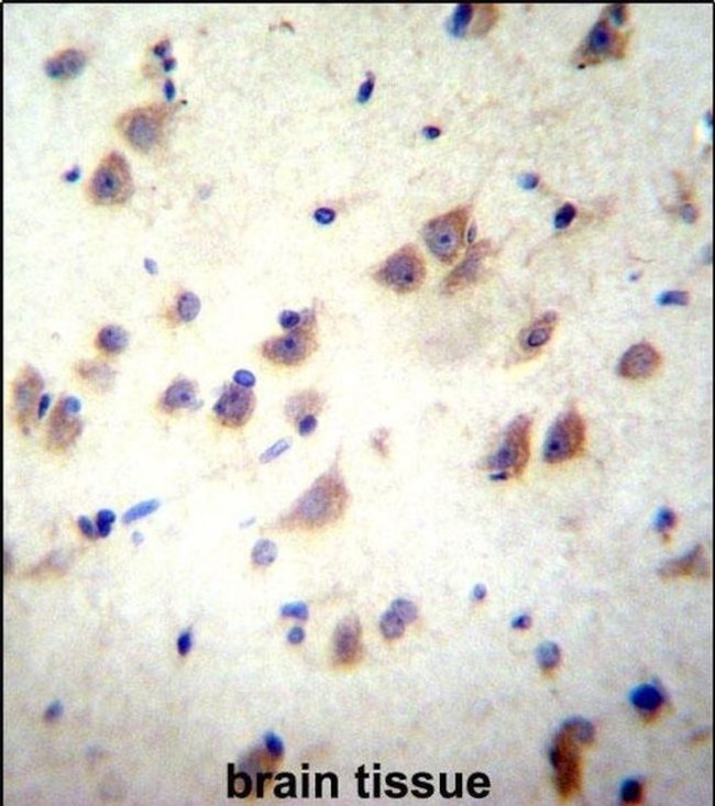 NMDAR3B Antibody in Immunohistochemistry (IHC)