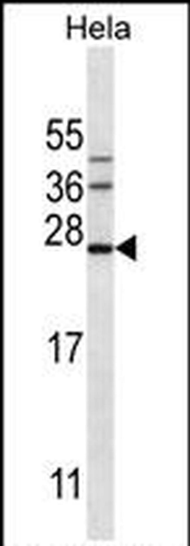 Serglycin Antibody in Western Blot (WB)
