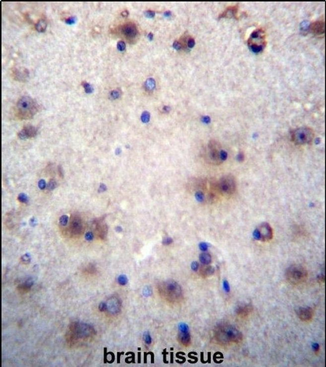 EVPLL Antibody in Immunohistochemistry (IHC)