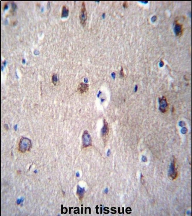 PCDHB14 Antibody in Immunohistochemistry (IHC)