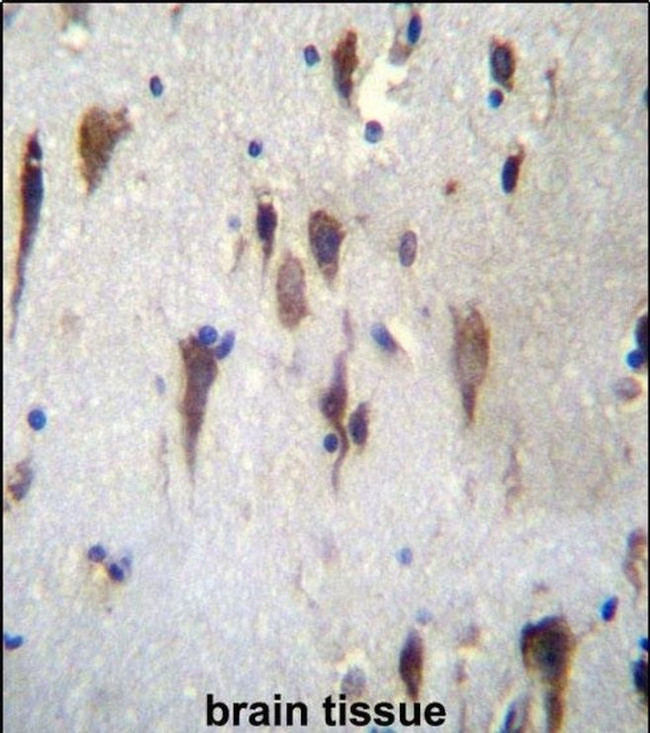 PCDH7 Antibody in Immunohistochemistry (IHC)