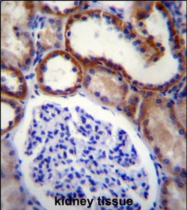 MAP3K15 Antibody in Immunohistochemistry (IHC)