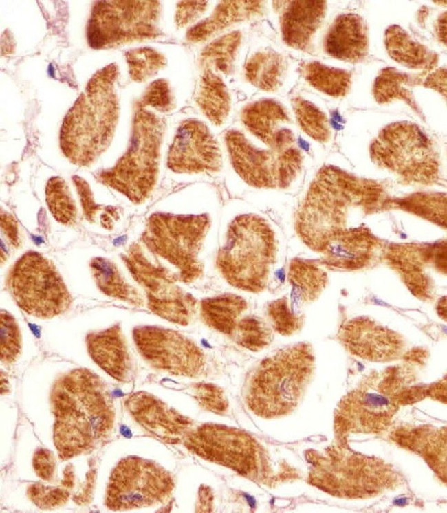 PCCA Antibody in Immunohistochemistry (IHC)