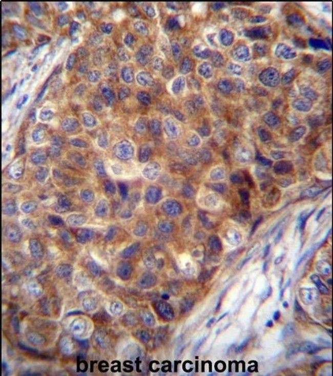 COX7A2L Antibody in Immunohistochemistry (IHC)
