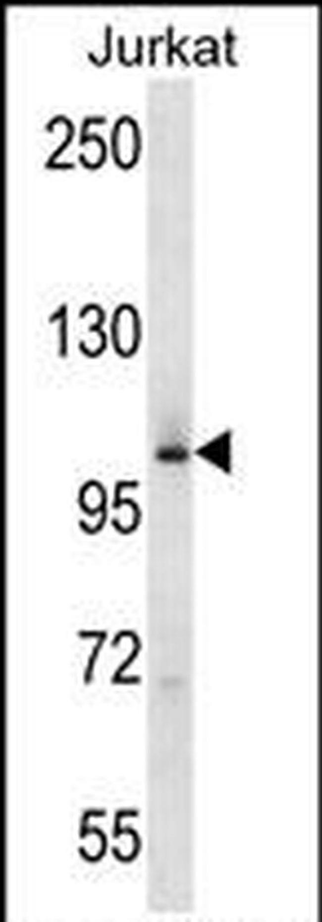 MAP4K2 Antibody in Western Blot (WB)