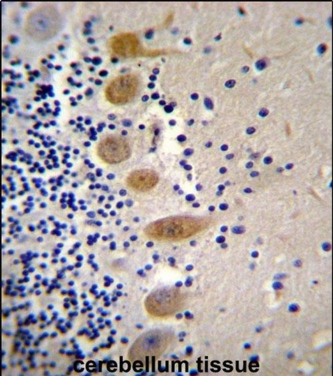 MST1 Antibody in Immunohistochemistry (IHC)