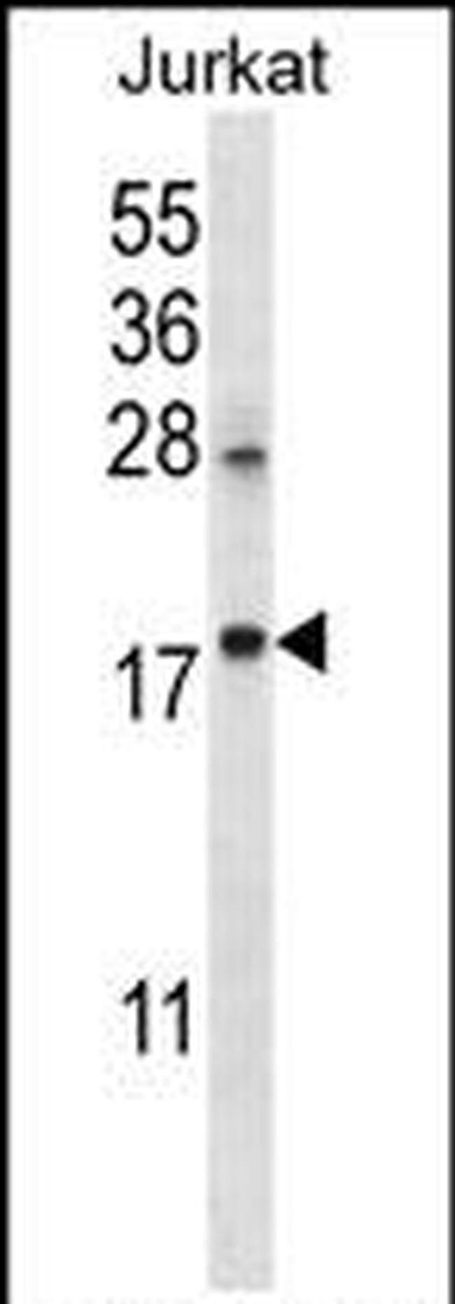 KRTAP25-1 Antibody in Western Blot (WB)