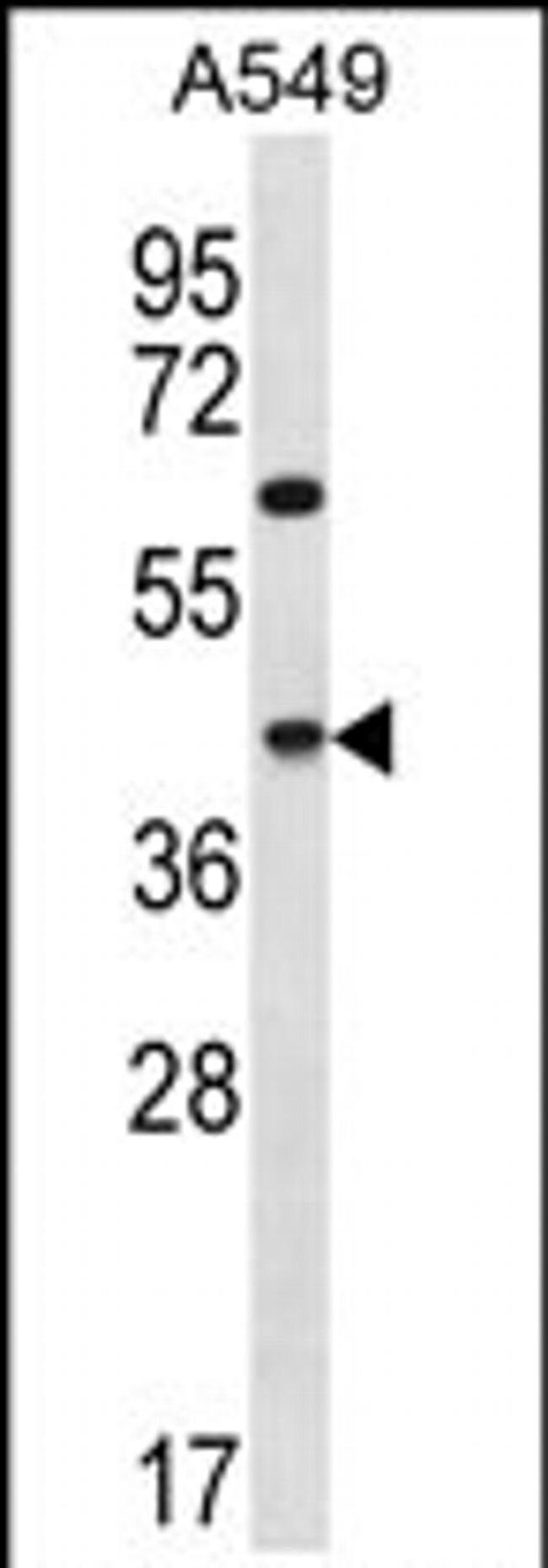 CCDC109B Antibody in Western Blot (WB)