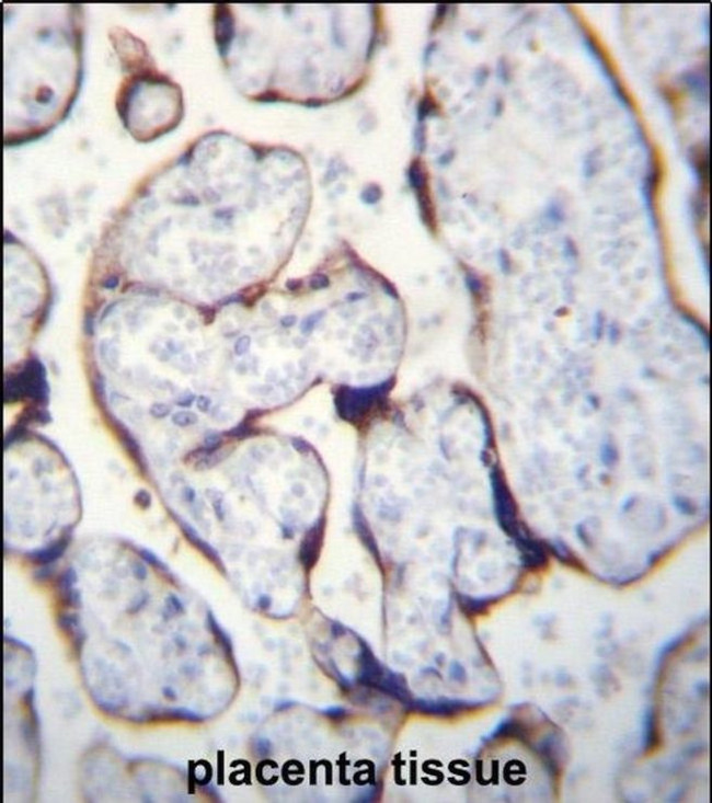 LETM2 Antibody in Immunohistochemistry (IHC)